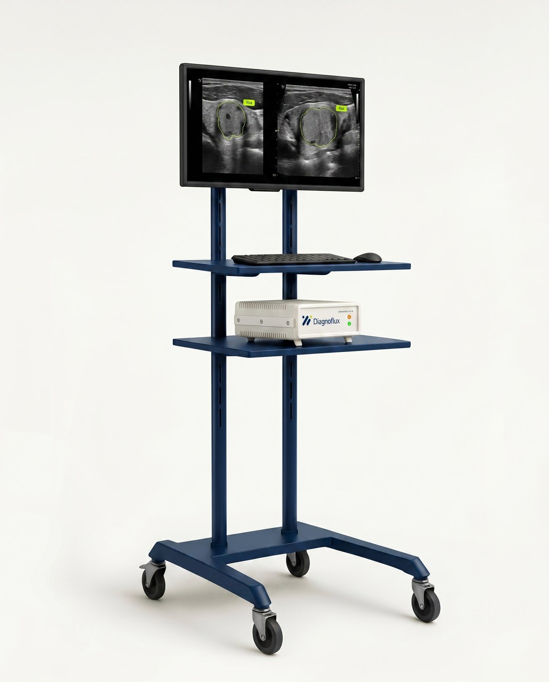 A Diagnoflux cart: a second monitor shows a dual-plane thyroid ultrasound with lime segmentation outlines and risk badges, above the Diagnoflux gateway box